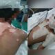 Dua kanak-kanak melecur sinki meletup angkara jiran guna asid