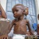 Lebih 7 juta kanak-kanak bawah lima tahun kurang zat makanan di seluruh Ethiopia, Kenya dan Somalia