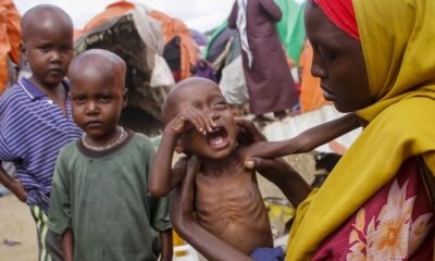 Lebih 700 juta penduduk dunia berdepan kebuluran kronik