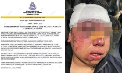 Patah hidung, penyokong dakwa dipukul anggota JMF ketika final Piala FA