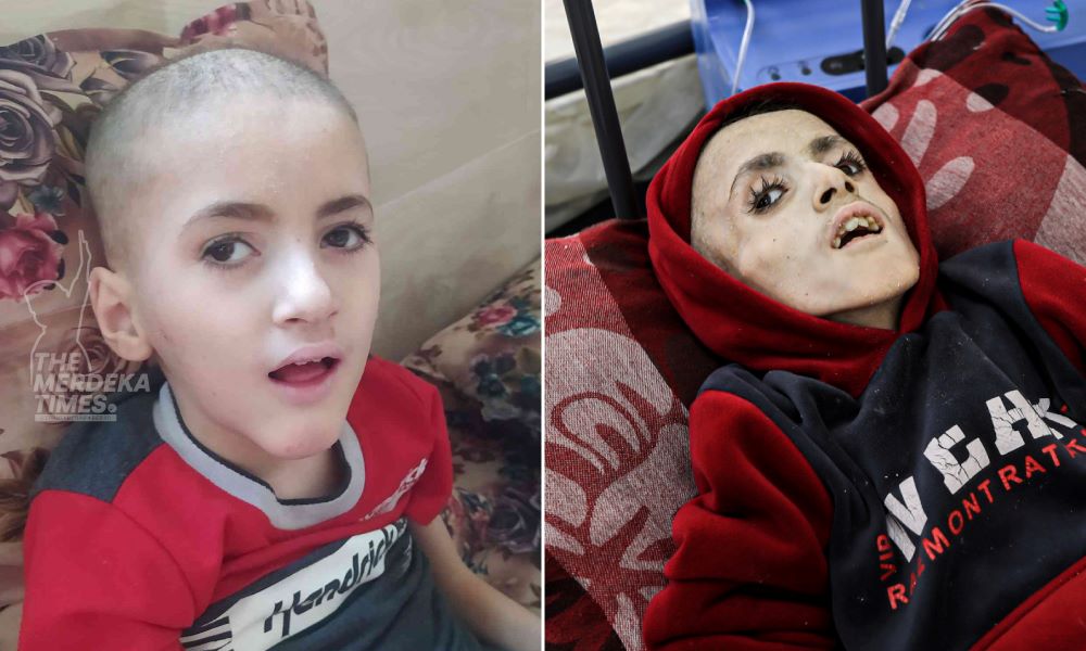 Yazan Al-Kafarneh, kanak-kanak Gaza mati kurus kering akibat kebuluran